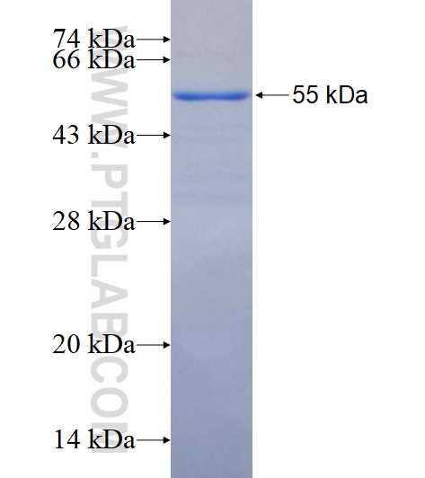 MAP1B fusion protein Ag16255 SDS-PAGE