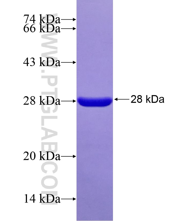 MAP1B fusion protein Ag17709 SDS-PAGE
