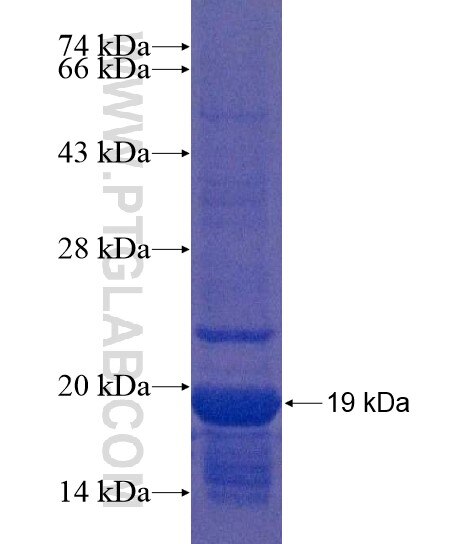 MAP1D fusion protein Ag22127 SDS-PAGE MAP1D fusion protein Ag22127 SDS-PAGE