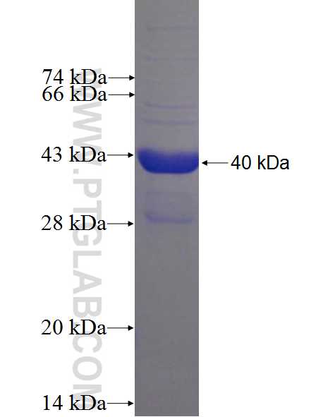 MAP1LC3A,LC3 fusion protein Ag2781 SDS-PAGE