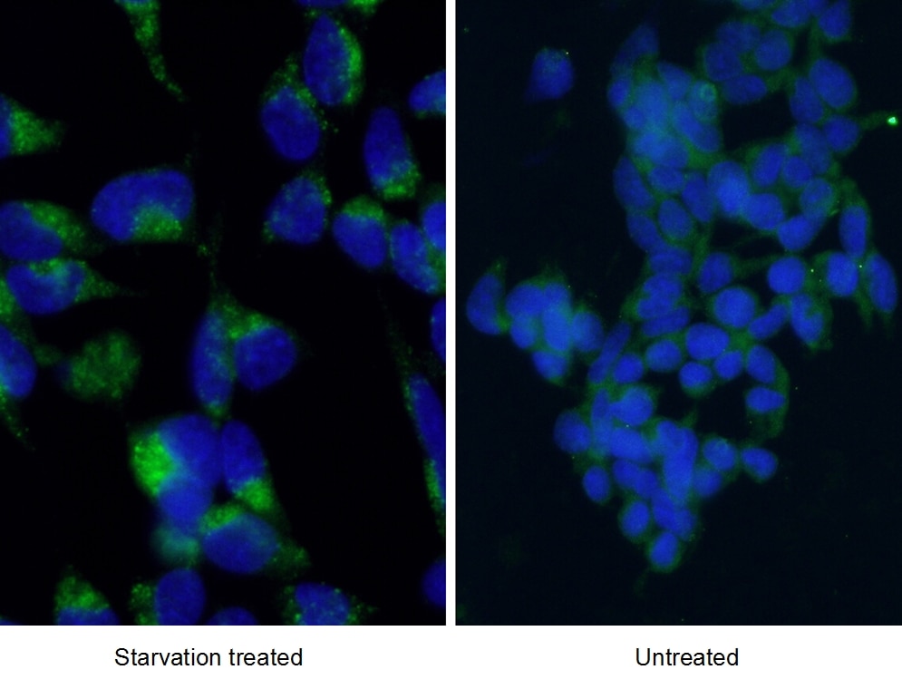 Immunofluorescence (IF) / fluorescent staining of HEK-293 cells using LC3 Polyclonal antibody (12135-1-AP)