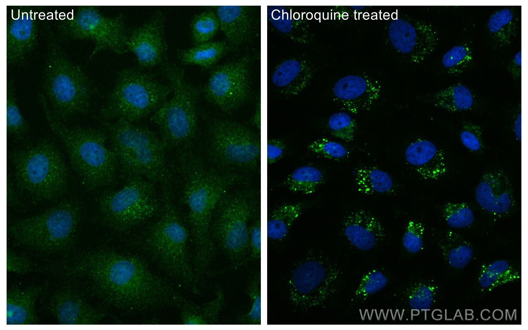 Immunofluorescence (IF) / fluorescent staining of HeLa cells using LC3 Monoclonal antibody (66139-3-Ig)