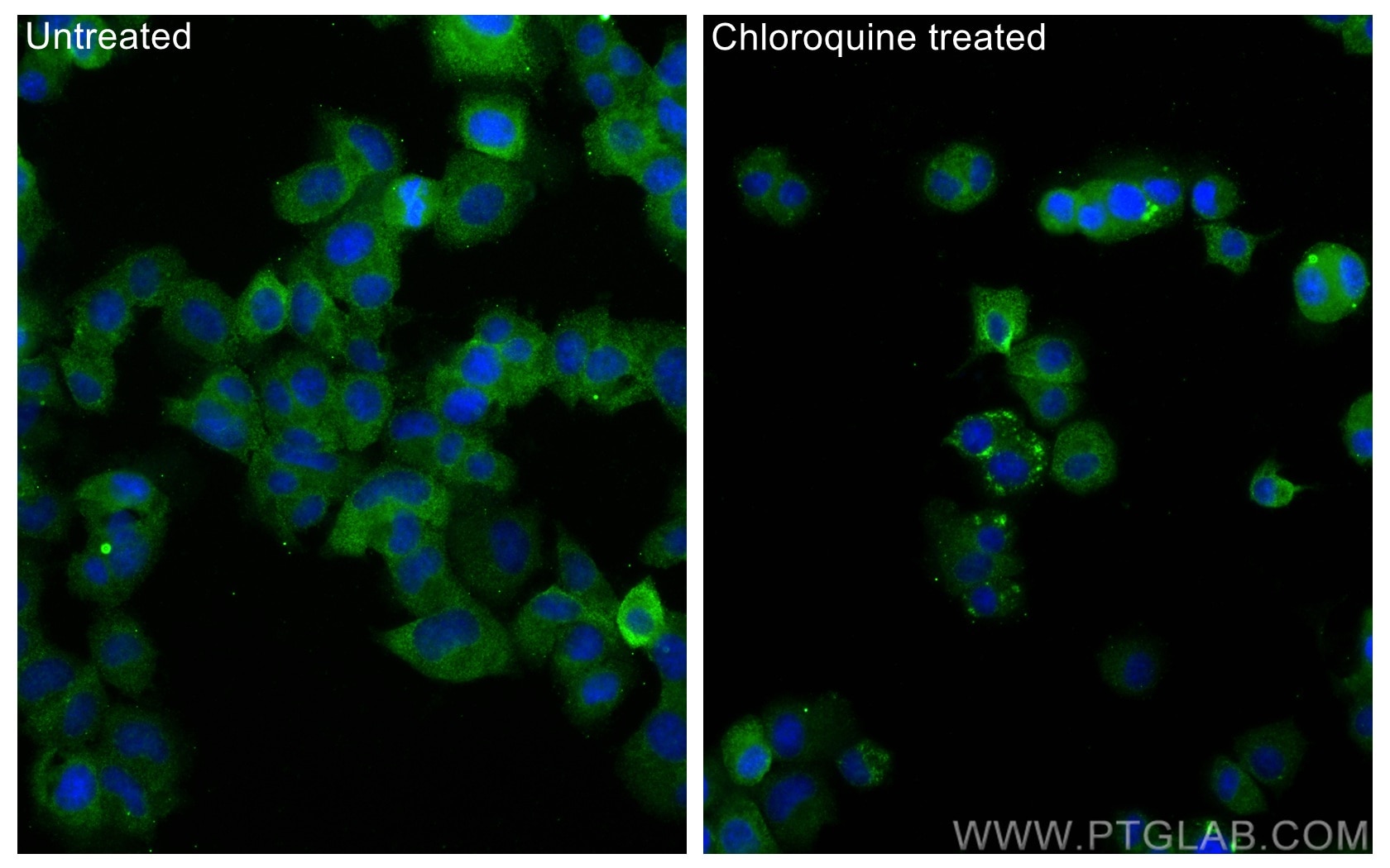 Immunofluorescence (IF) / fluorescent staining of PC-12 cells using MAP1LC3A,LC3 Monoclonal antibody (66139-3-Ig)