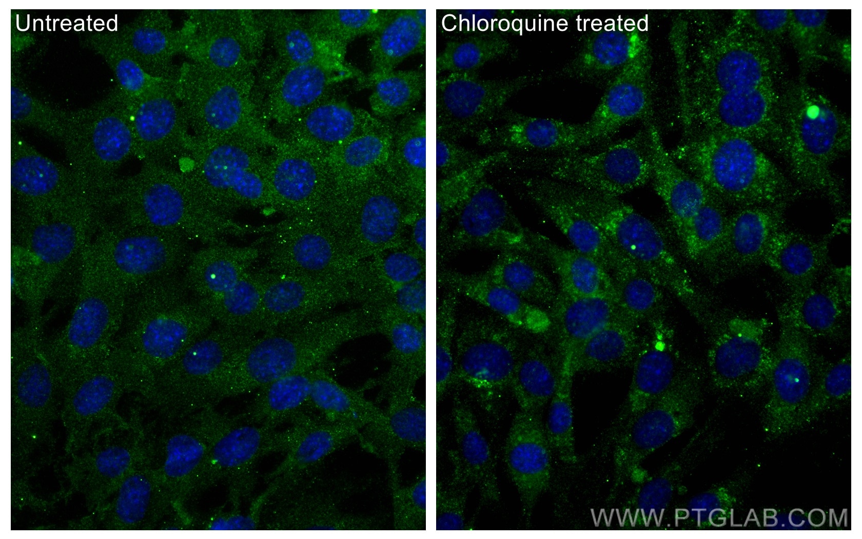 Immunofluorescence (IF) / fluorescent staining of NIH/3T3 cells using MAP1LC3A,LC3 Monoclonal antibody (66139-3-Ig)