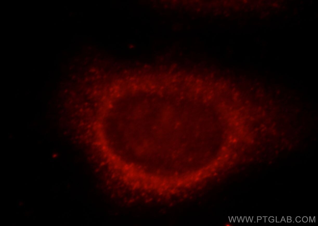 Immunofluorescence (IF) / fluorescent staining of HepG2 cells using LC3A-Specific Polyclonal antibody (18722-1-AP)