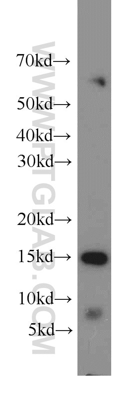 Western Blot (WB) analysis of human brain tissue using LC3A-Specific Polyclonal antibody (18722-1-AP)