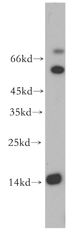 Western Blot (WB) analysis of mouse brain tissue using LC3A-Specific Polyclonal antibody (18722-1-AP)