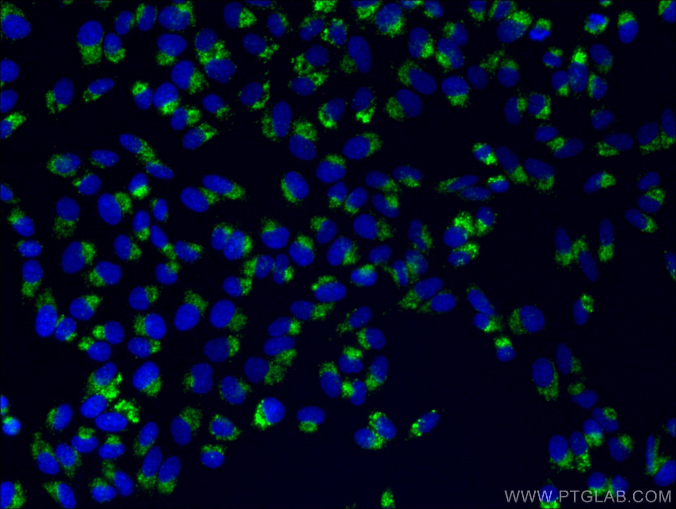 IF Staining of HepG2 using 14600-1-AP