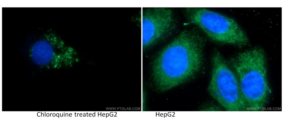 LC3 Polyclonal antibody