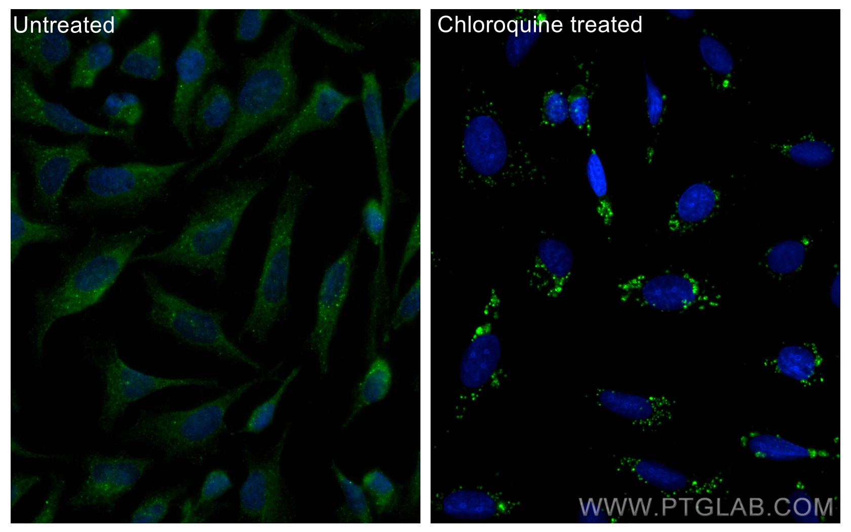 Immunofluorescence (IF) / fluorescent staining of U2OS cells using LC3 Polyclonal antibody (14600-1-AP)