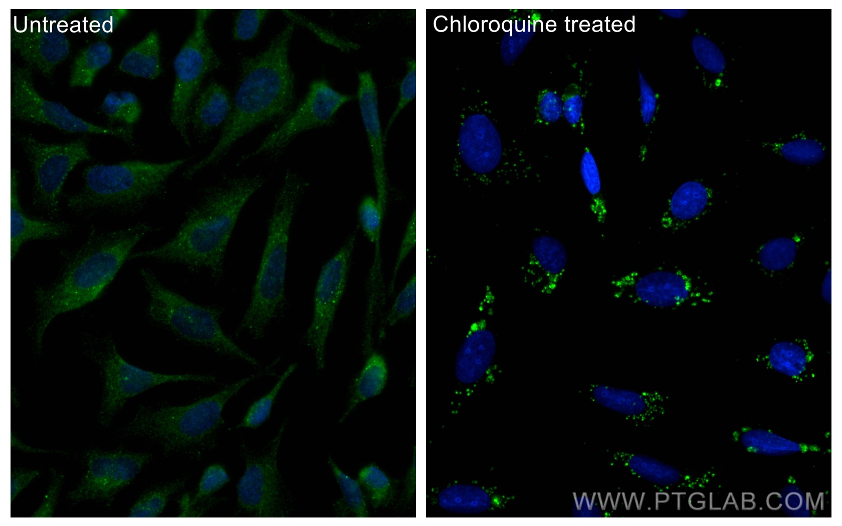 IF Staining of U2OS using 14600-1-AP