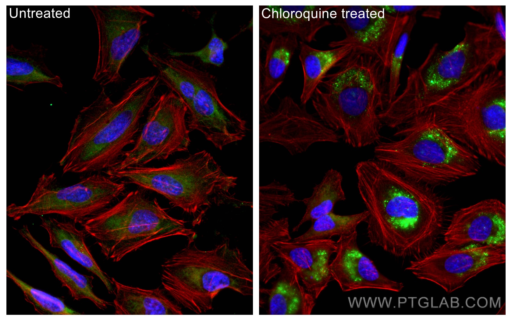 Immunofluorescence (IF) / fluorescent staining of HeLa cells using LC3 Polyclonal antibody (14600-1-AP)