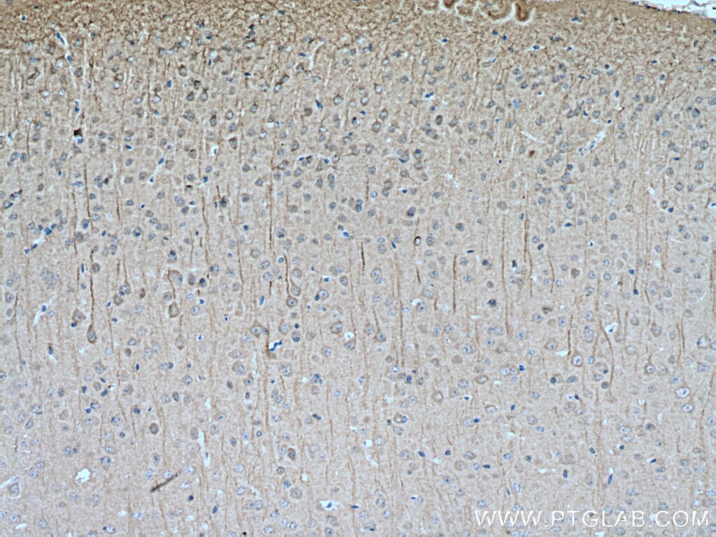 IHC staining of mouse brain using 14600-1-AP