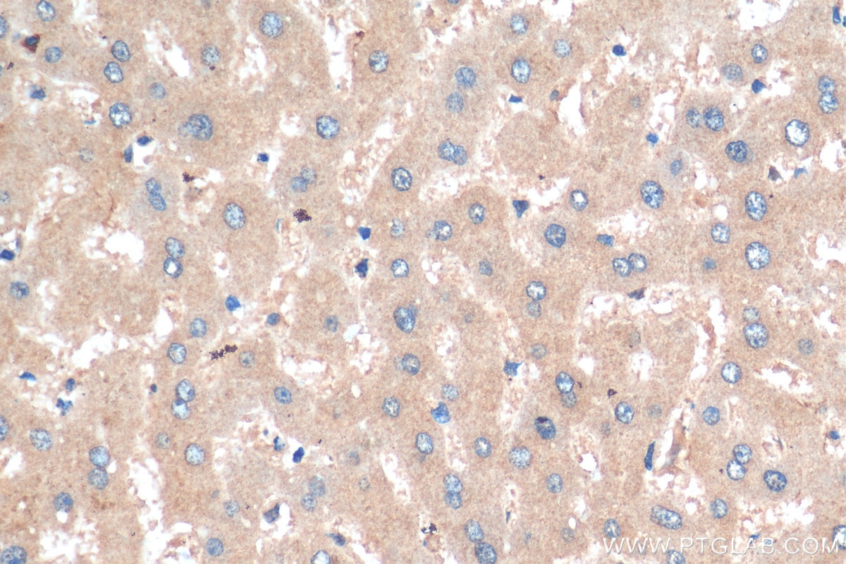 Immunohistochemistry (IHC) staining of human liver tissue using LC3 Polyclonal antibody (14600-1-AP)