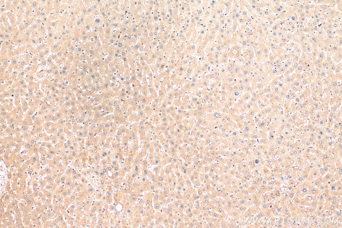 Immunohistochemistry (IHC) staining of human liver tissue using LC3 Polyclonal antibody (14600-1-AP)