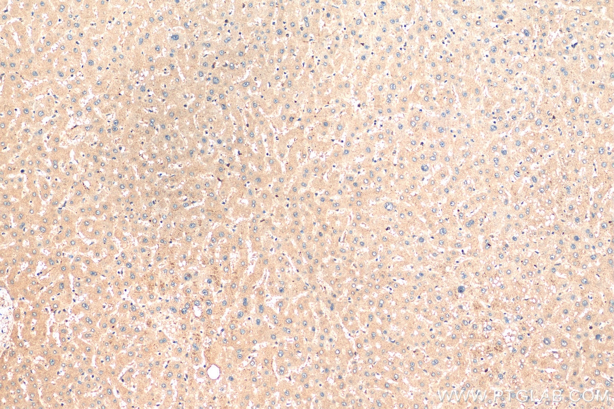 IHC staining of human liver using 14600-1-AP