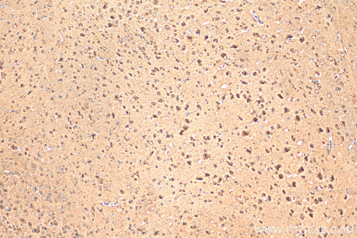 Immunohistochemistry (IHC) staining of mouse brain tissue using LC3 Polyclonal antibody (14600-1-AP)