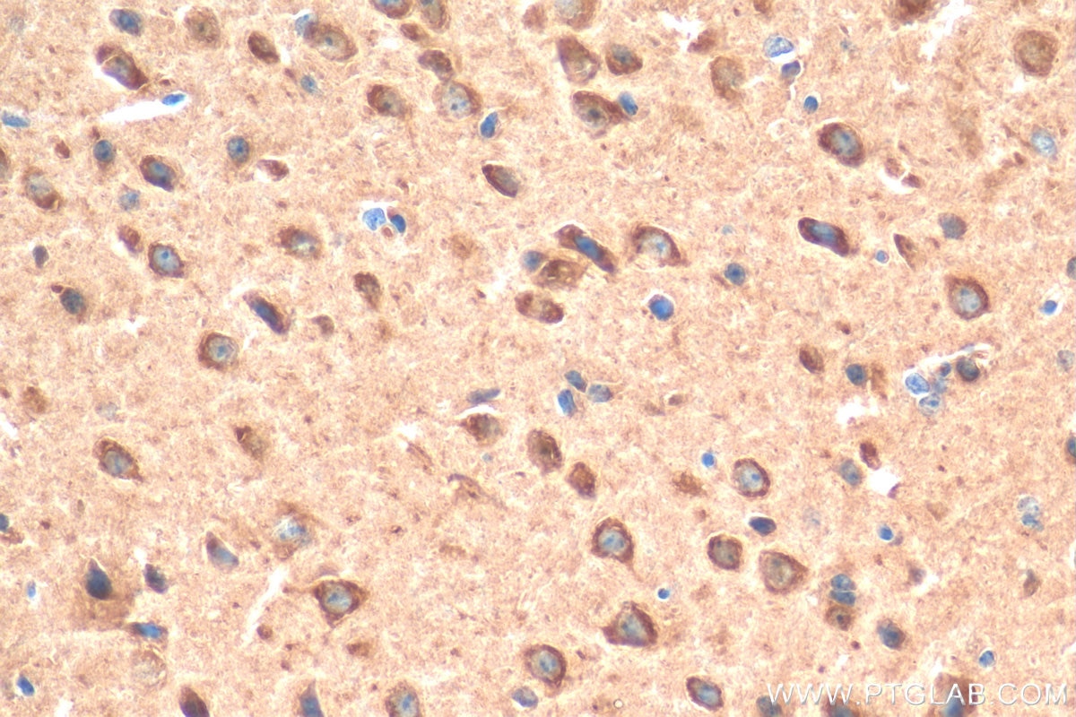 Immunohistochemistry (IHC) staining of mouse brain tissue using LC3 Polyclonal antibody (14600-1-AP)