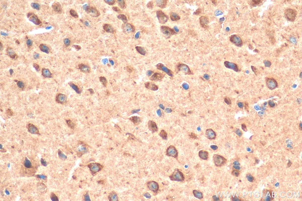 IHC staining of mouse brain using 14600-1-AP