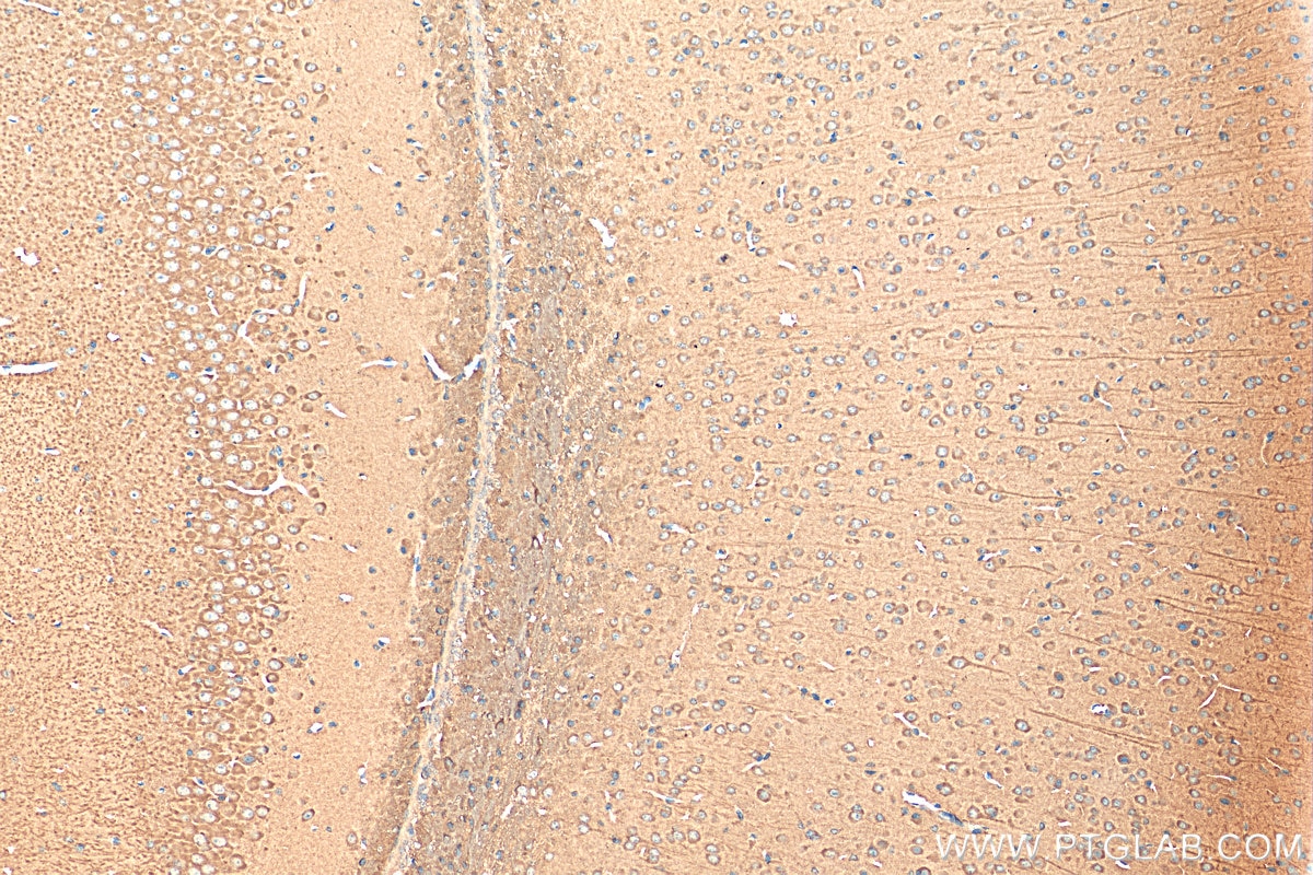 Immunohistochemistry (IHC) staining of mouse brain tissue using LC3 Polyclonal antibody (14600-1-AP)
