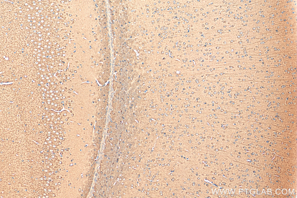 IHC staining of mouse brain using 14600-1-AP