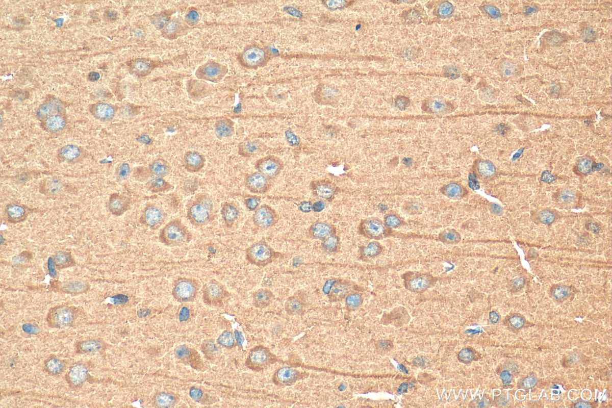 Immunohistochemistry (IHC) staining of mouse brain tissue using LC3 Polyclonal antibody (14600-1-AP)