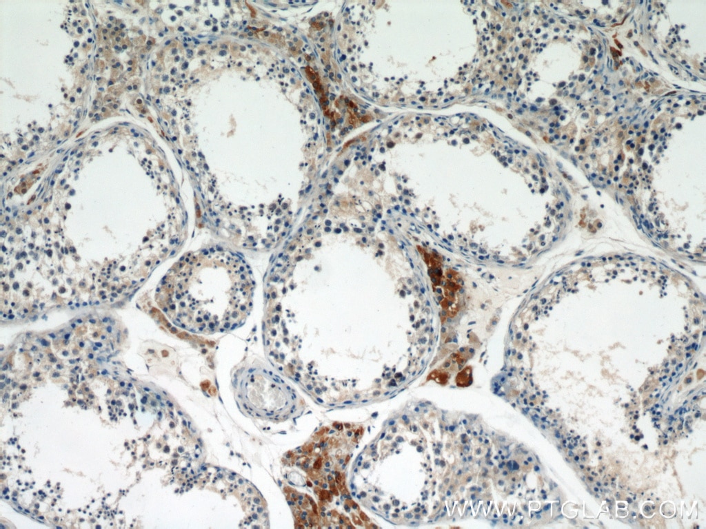 Immunohistochemistry (IHC) staining of human testis tissue using LC3 Polyclonal antibody (14600-1-AP)