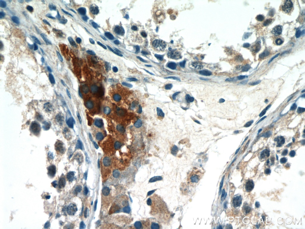Immunohistochemistry (IHC) staining of human testis tissue using LC3 Polyclonal antibody (14600-1-AP)