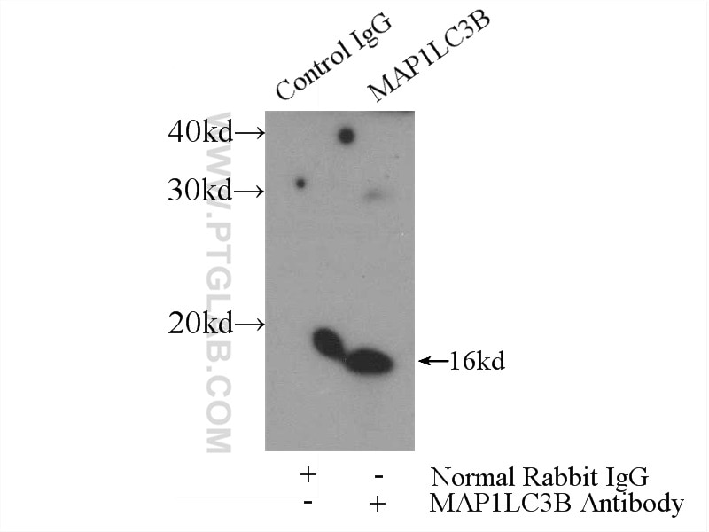 Immunoprecipitation (IP) experiment of mouse brain tissue using LC3 Polyclonal antibody (14600-1-AP)