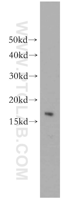 WB analysis of mouse testis using 14600-1-AP