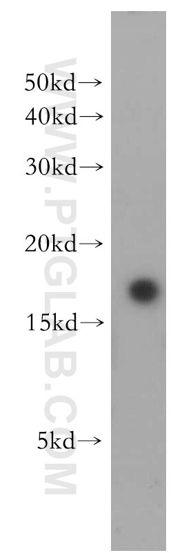 Western Blot (WB) analysis of human skeletal muscle tissue using LC3 Polyclonal antibody (14600-1-AP)