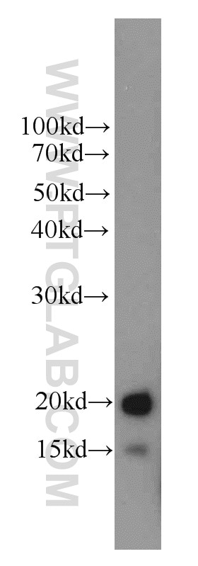 Western Blot (WB) analysis of mouse brain tissue using LC3 Polyclonal antibody (14600-1-AP)