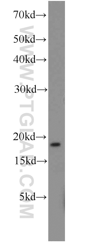 Western Blot (WB) analysis of mouse liver tissue using LC3 Polyclonal antibody (14600-1-AP)