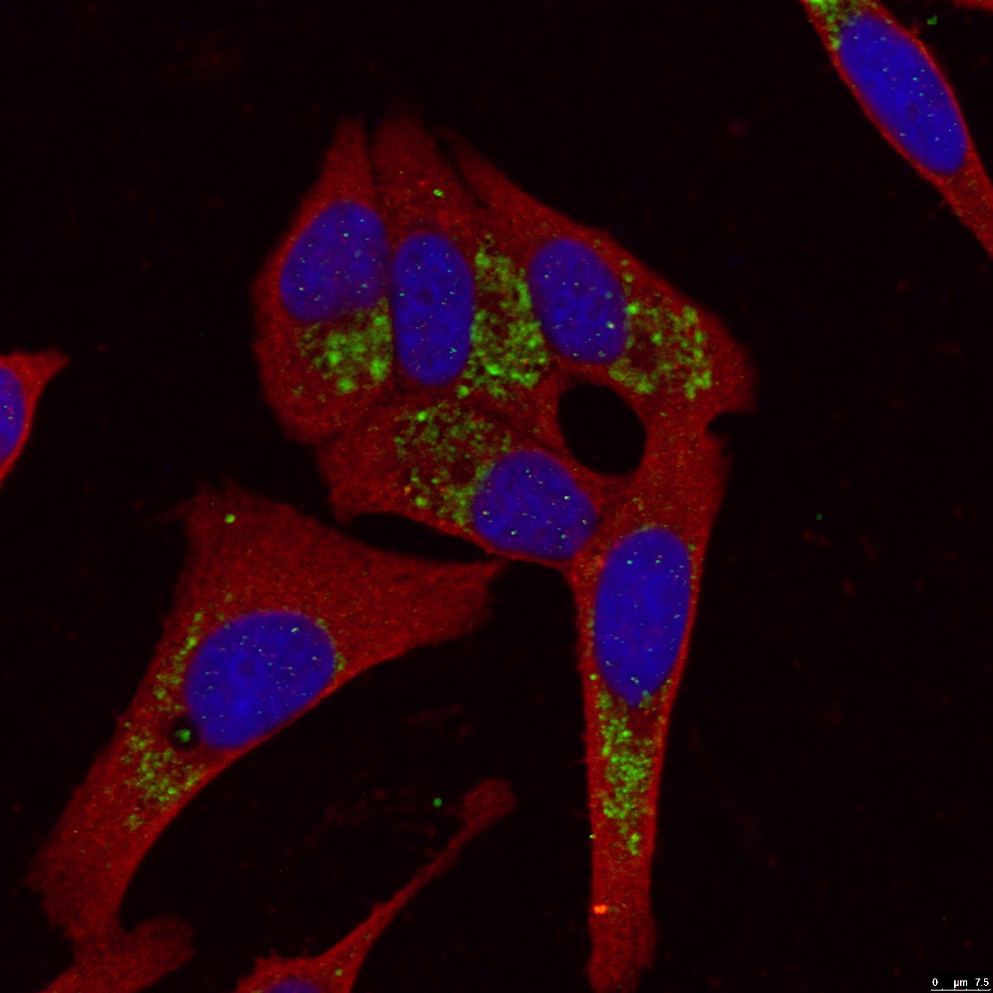 Immunofluorescence (IF) / fluorescent staining of HepG2 cells using LC3B-Specific Polyclonal antibody (18725-1-AP)