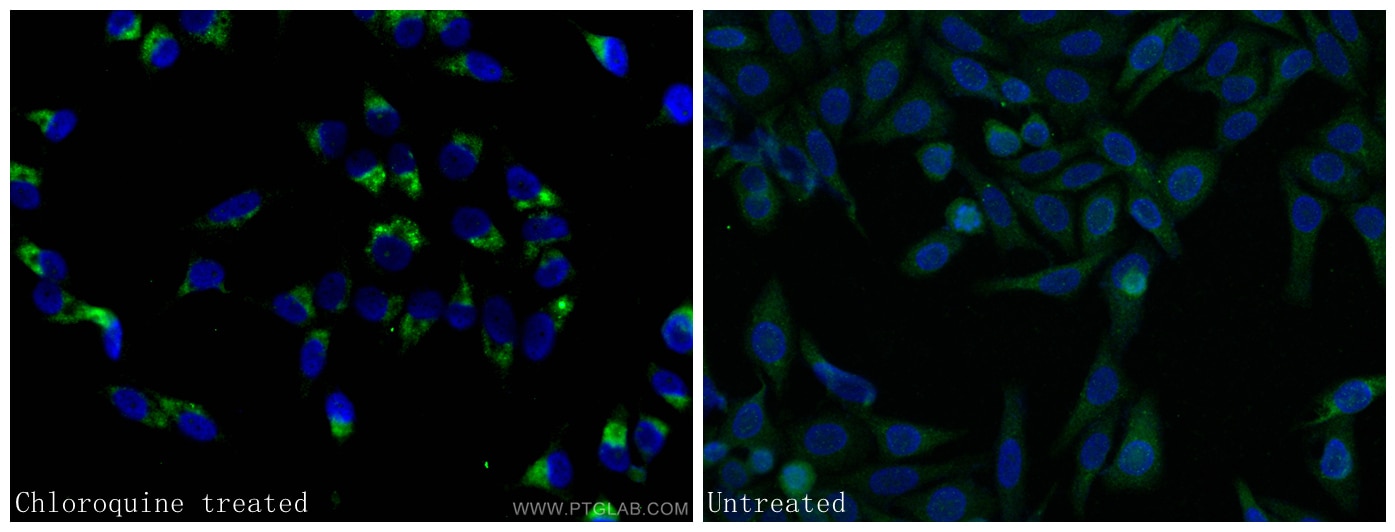 Immunofluorescence (IF) / fluorescent staining of HepG2 cells using LC3B-Specific Polyclonal antibody (18725-1-AP)