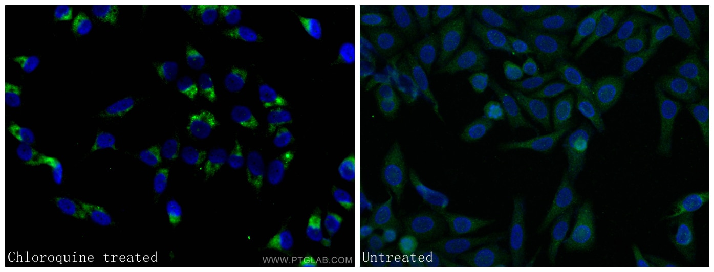 IF Staining of HepG2 using 18725-1-AP