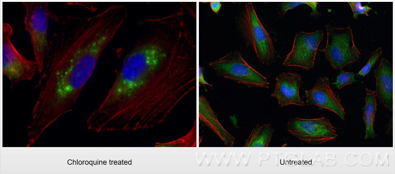 Immunofluorescence (IF) / fluorescent staining of HeLa cells using LC3B-Specific Polyclonal antibody (18725-1-AP)
