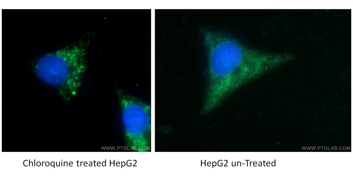 LC3B-Specific Polyclonal antibody