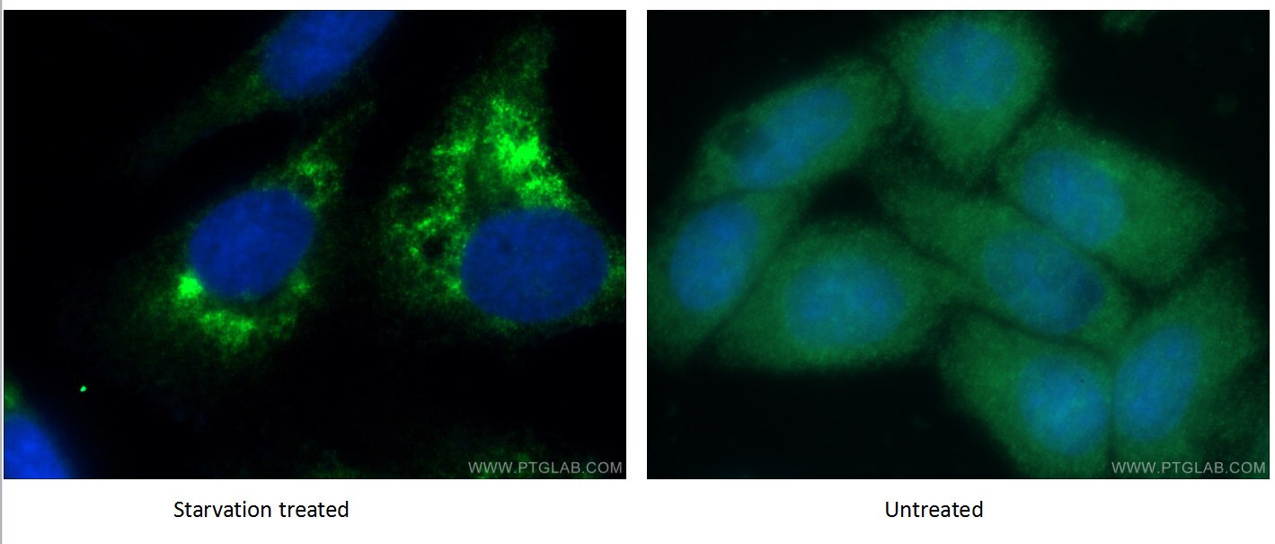 Immunofluorescence (IF) / fluorescent staining of HepG2 cells using LC3B-Specific Polyclonal antibody (18725-1-AP)