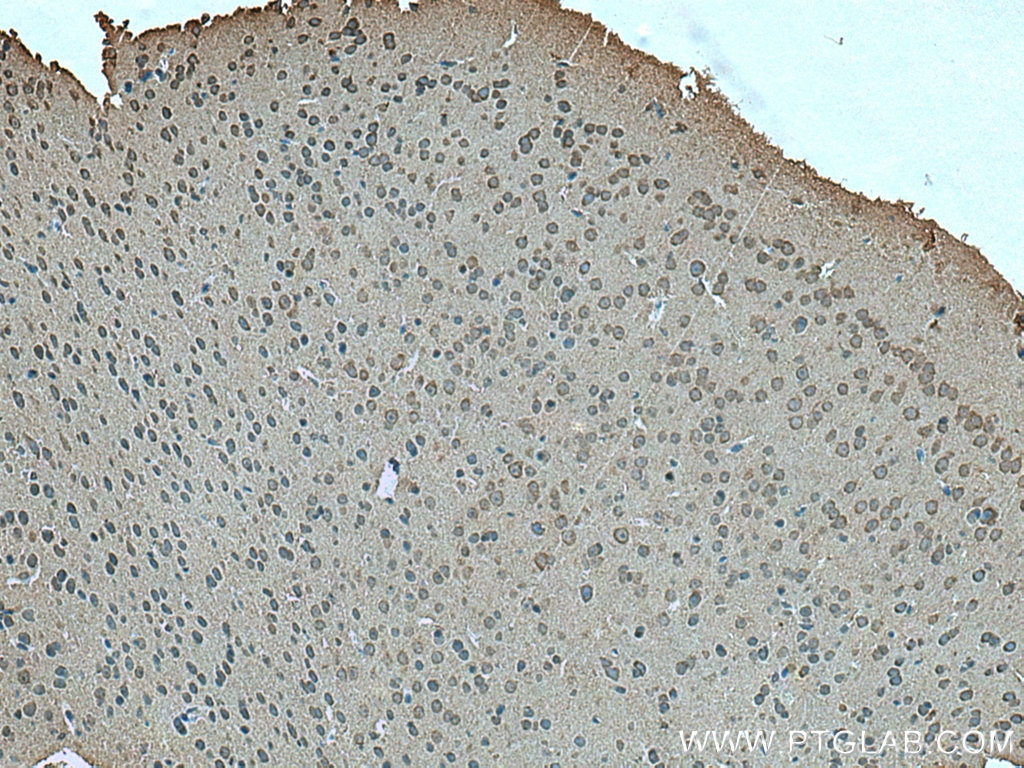 Immunohistochemistry (IHC) staining of mouse brain tissue using LC3B-Specific Polyclonal antibody (18725-1-AP)