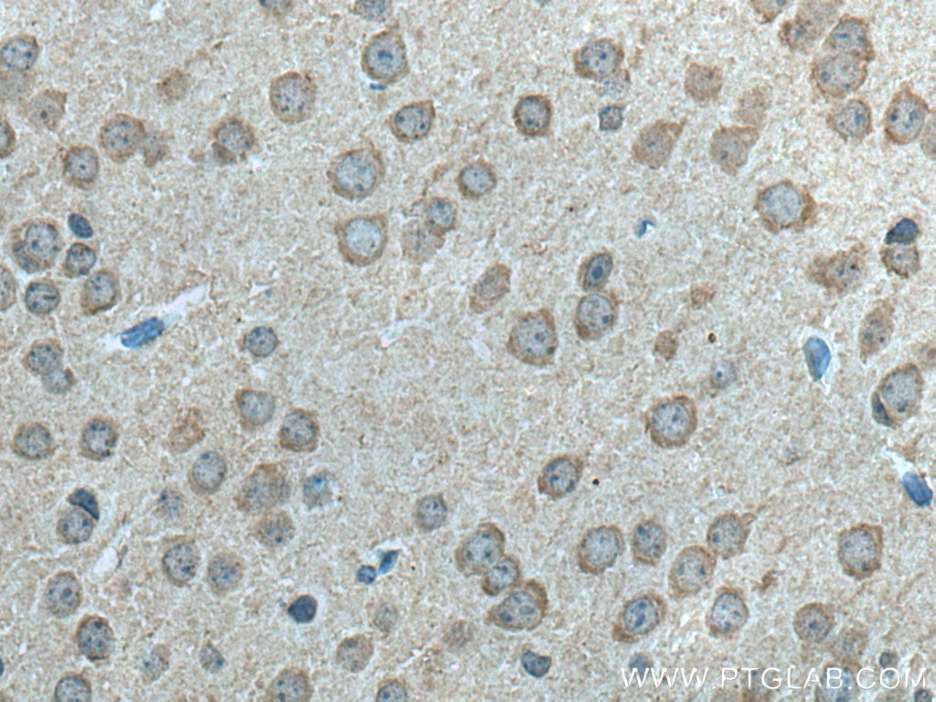 Immunohistochemistry (IHC) staining of mouse brain tissue using LC3B-Specific Polyclonal antibody (18725-1-AP)