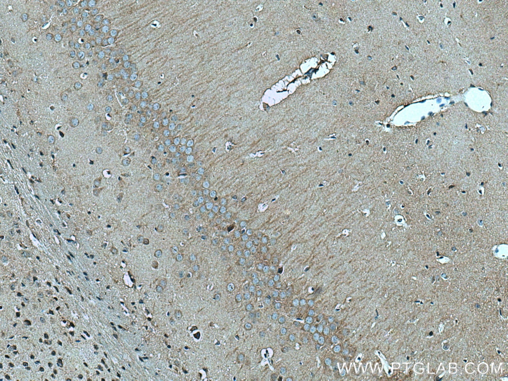 Immunohistochemistry (IHC) staining of mouse brain tissue using LC3B-Specific Polyclonal antibody (18725-1-AP)