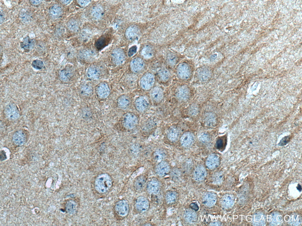 Immunohistochemistry (IHC) staining of mouse brain tissue using LC3B-Specific Polyclonal antibody (18725-1-AP)