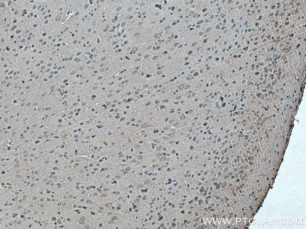 Immunohistochemistry (IHC) staining of rat brain tissue using LC3B-Specific Polyclonal antibody (18725-1-AP)