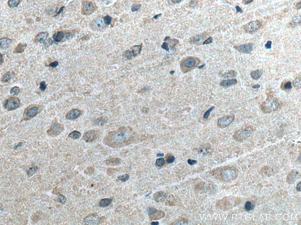 IHC staining of rat brain using 18725-1-AP