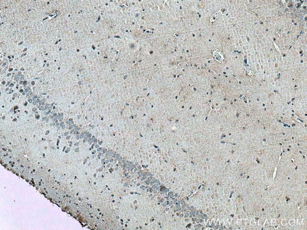 Immunohistochemistry (IHC) staining of rat brain tissue using LC3B-Specific Polyclonal antibody (18725-1-AP)