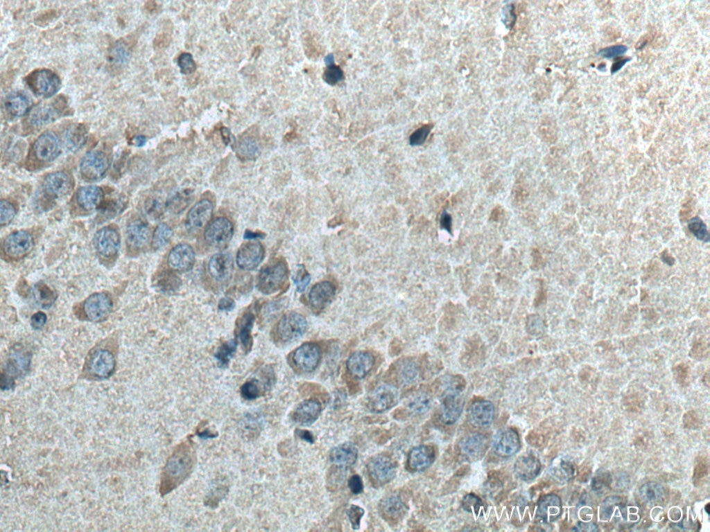 Immunohistochemistry (IHC) staining of rat brain tissue using LC3B-Specific Polyclonal antibody (18725-1-AP)