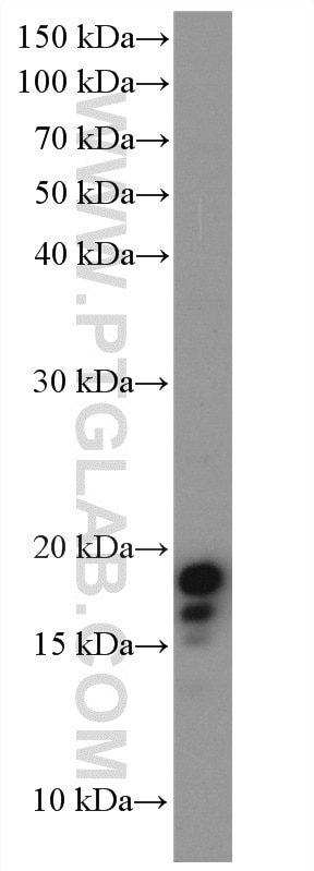 Western Blot (WB) analysis of A549 cells using LC3B-Specific Polyclonal antibody (18725-1-AP)