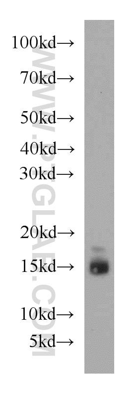 Western Blot (WB) analysis of mouse brain tissue using LC3B-Specific Polyclonal antibody (18725-1-AP)