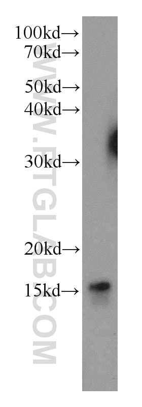 Western Blot (WB) analysis of MCF-7 cells using LC3B-Specific Polyclonal antibody (18725-1-AP)